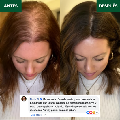 RevHair™ | Jabón Coreano Natural para Reducir la Caída y Fortalecer Cabello