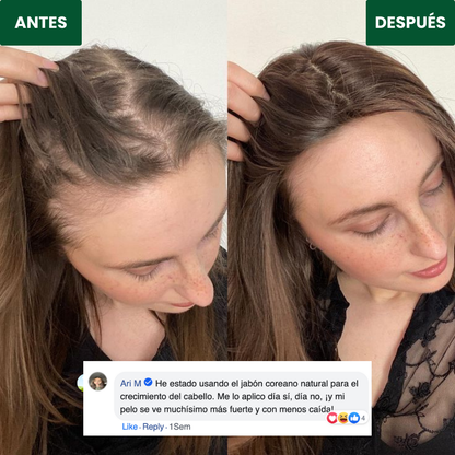 RevHair™ | Jabón Coreano Natural para Reducir la Caída y Fortalecer Cabello