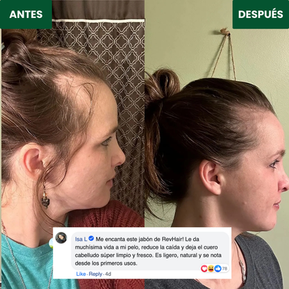 RevHair™ | Jabón Coreano Natural para Reducir la Caída y Fortalecer Cabello